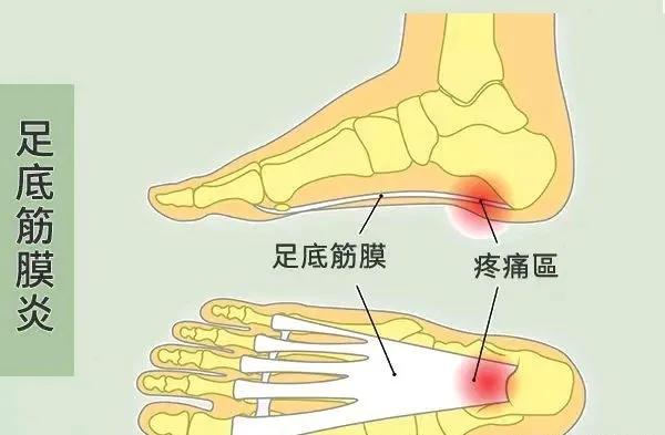 没有美人鱼的命，却有“美人鱼的病”