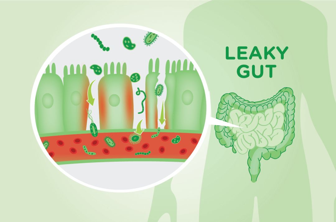 哪些问题属于内分泌失调,肠道菌群失调与甲状腺疾病有关