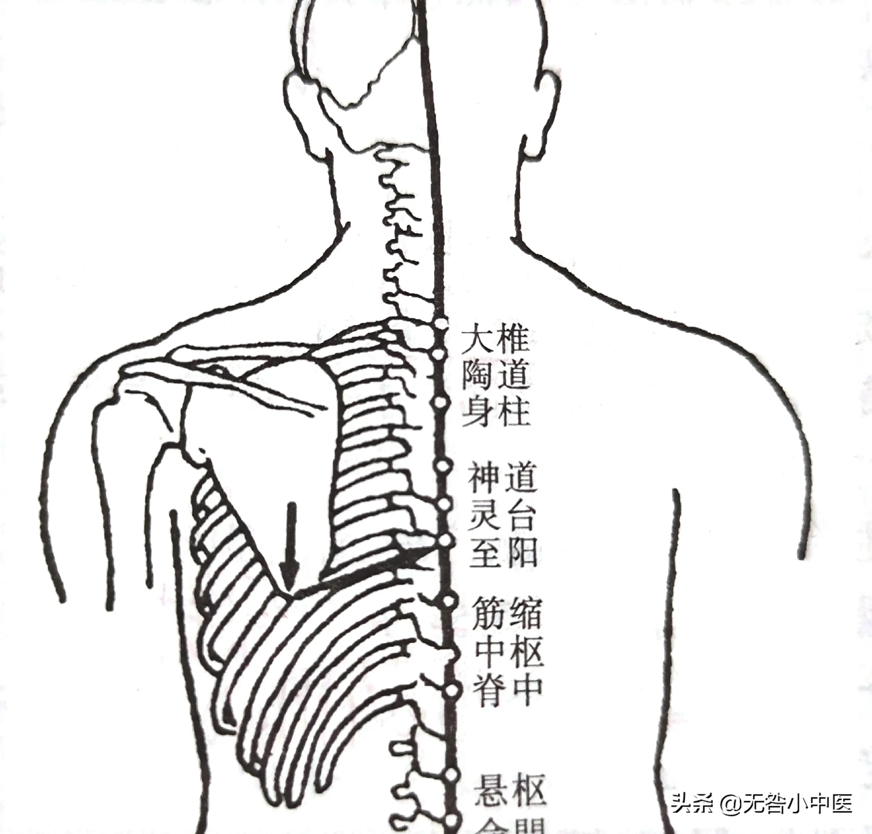 13针针灸的视频,督脉身柱