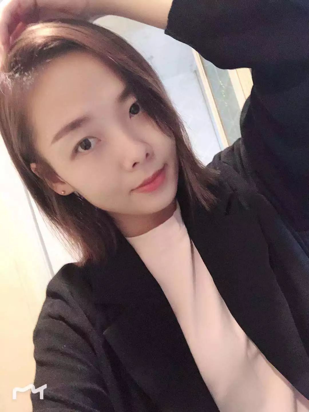 重度烧伤的河南小伙，天猫双11给女友买裙子，希望娶她过门