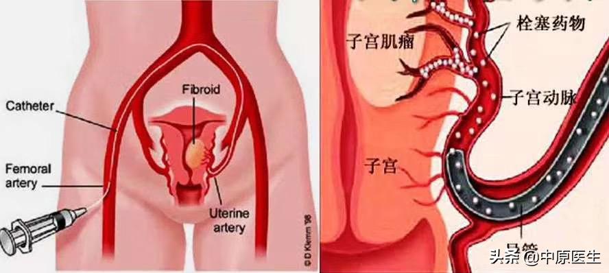 鎴戝湪鏂板啝鐤儏涓殑缁忓巻,鍦ㄦ柊鍐犵柅鎯呮劅鏌撲笅鐨勬垜