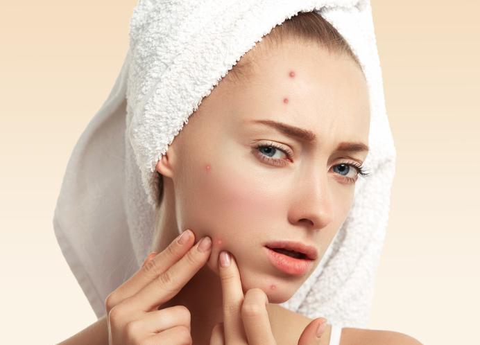 下巴不停长白色粉刺,下巴闭合粉刺挤出来白色的