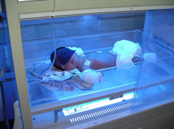 常见高危新生儿疾病课件,新生儿常见先天性疾病