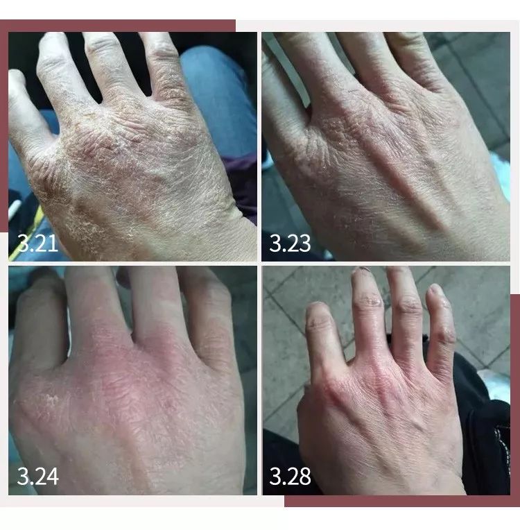 蔡依林护肤视频,蔡依林皮肤特护霜