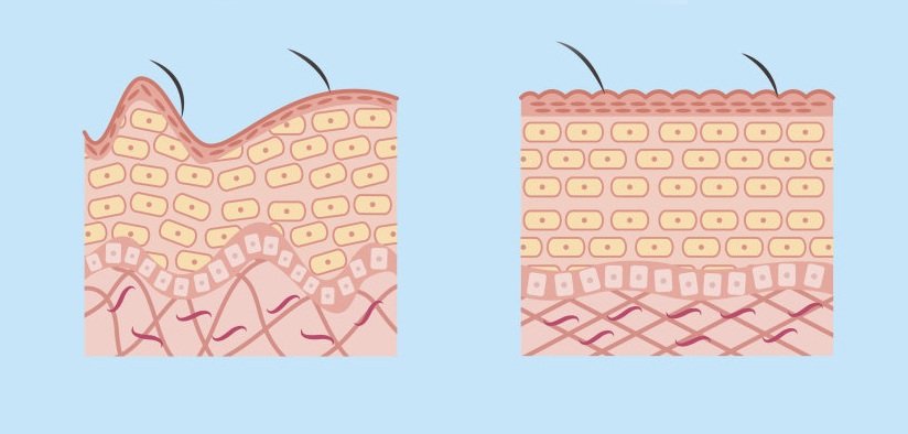 护肤重要步骤：根据这三步挑精华，皮肤再差都有救