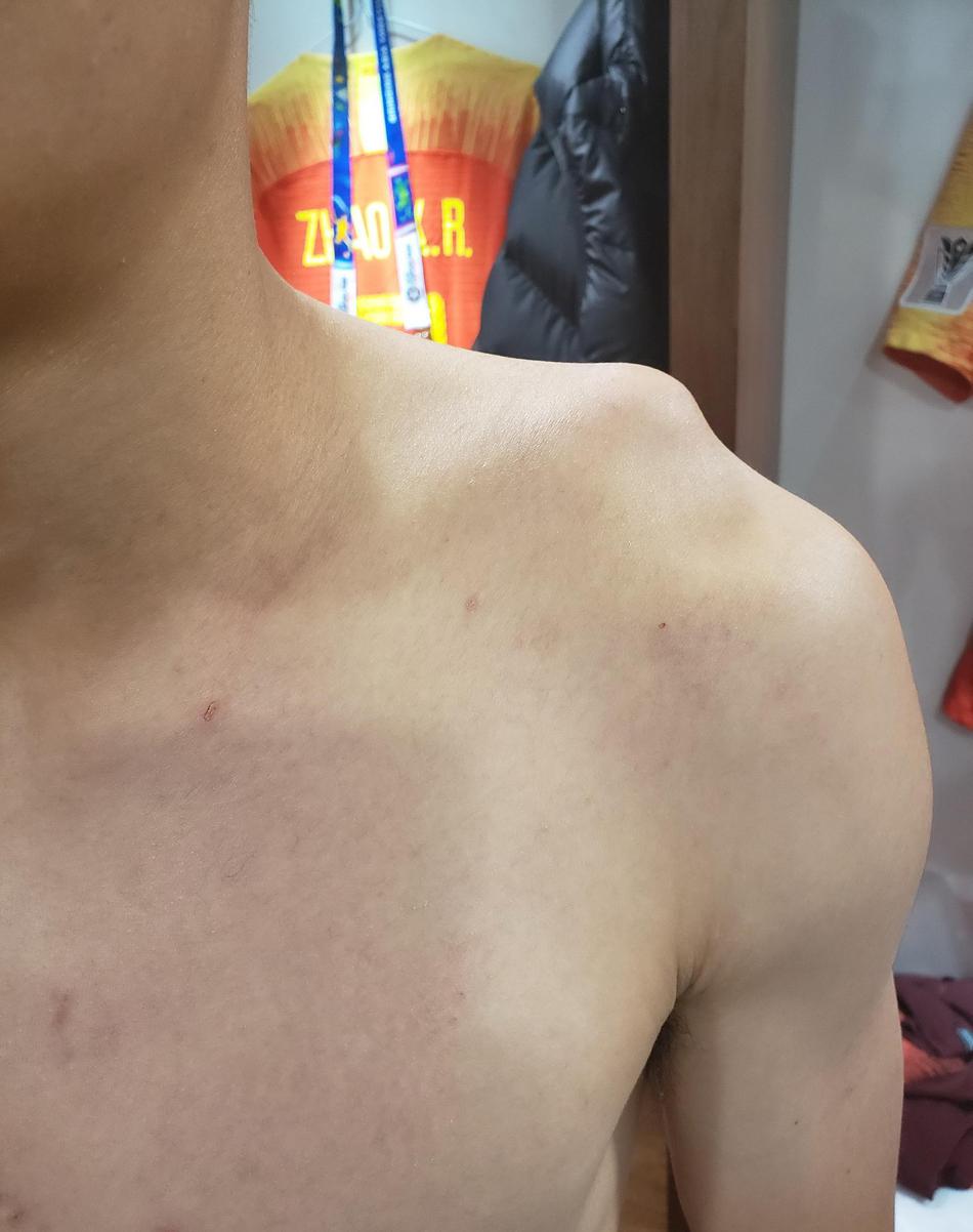 武磊伤情最新视频,武磊伤情