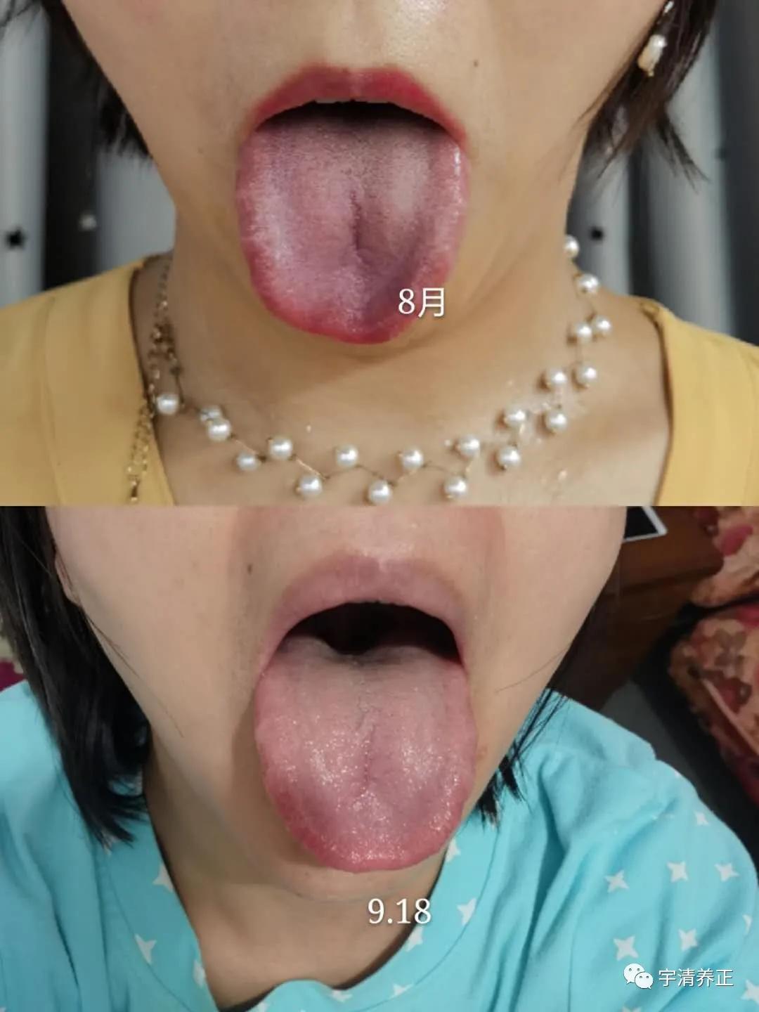 站桩可以对抗抑郁症,站桩帮助我走出抑郁痛苦