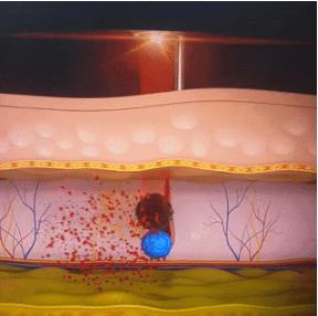 化妆都遮不住的“*褐斑黄**”？樊哥来拯救你了