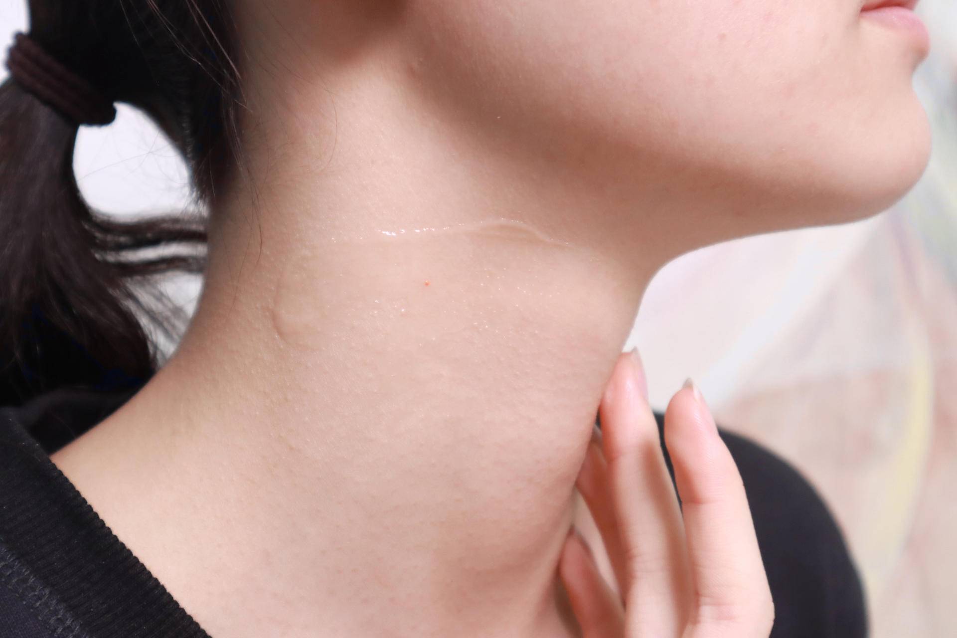 去颈纹用什么护颈霜效果好,哪个牌子的颈霜去颈纹效果最好