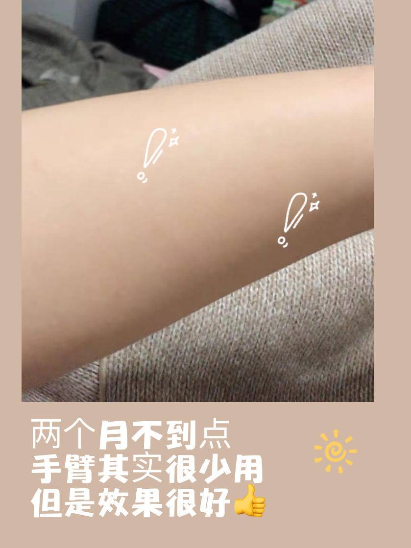 脱毛仪买了一年了还有效果吗,脱毛仪到底哪个好用啊