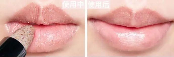 黑头皮肤屏障脆弱容易色素沉着,皮肤黑头闭口暗沉