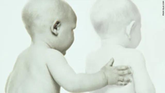 减胎需要做什么准备,减胎成功率高吗