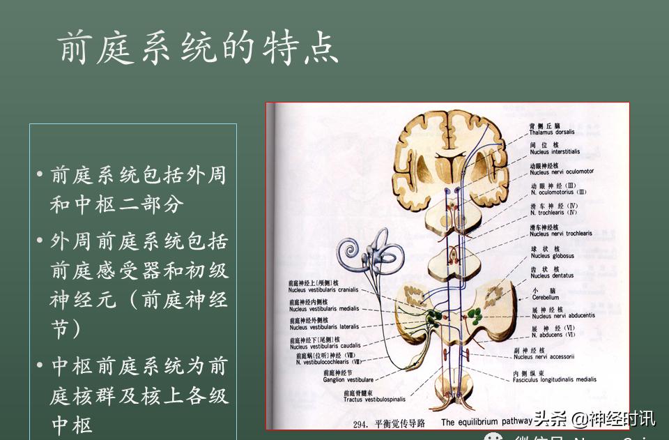 良性位置性眩晕诊断和治疗指南,良性阵发性位置性眩晕的诊断标准