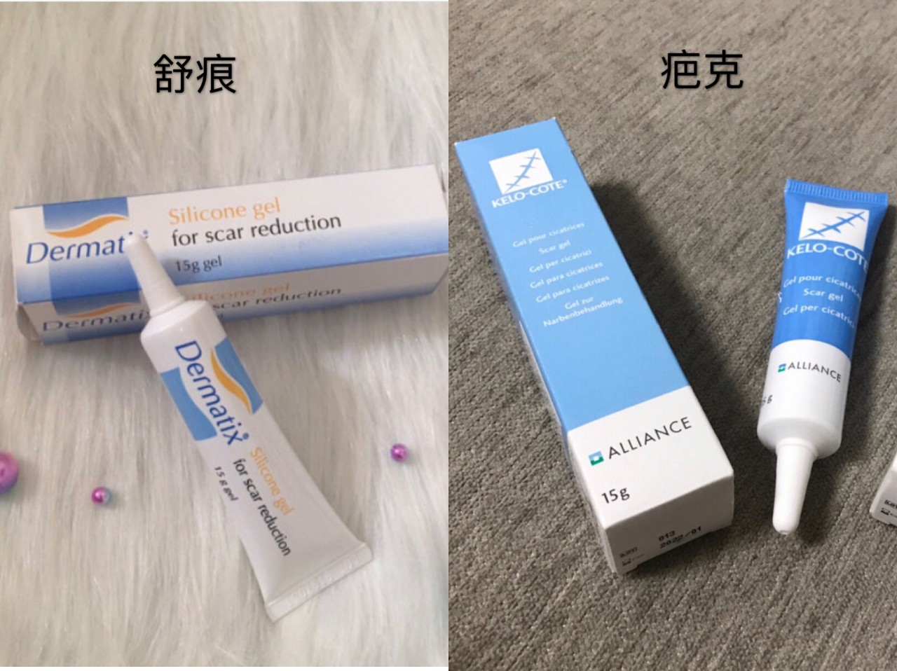 做双眼皮医生不会告诉你的真相,武汉割双眼皮亲身经历