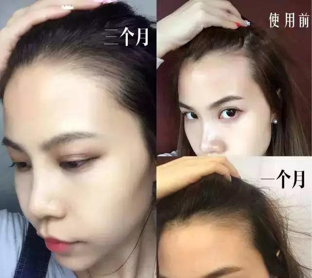 明星亲测有效的护肤品,明星亲测