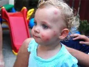 适合婴儿用的避蚊剂,宝宝防蚊喷雾成分