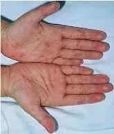 一个月疫情的死亡率,近一个月疫情有多少人死