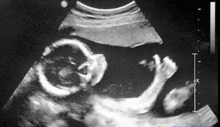 骨科医院拍片有哪几种,医院骨科拍片一般多少钱