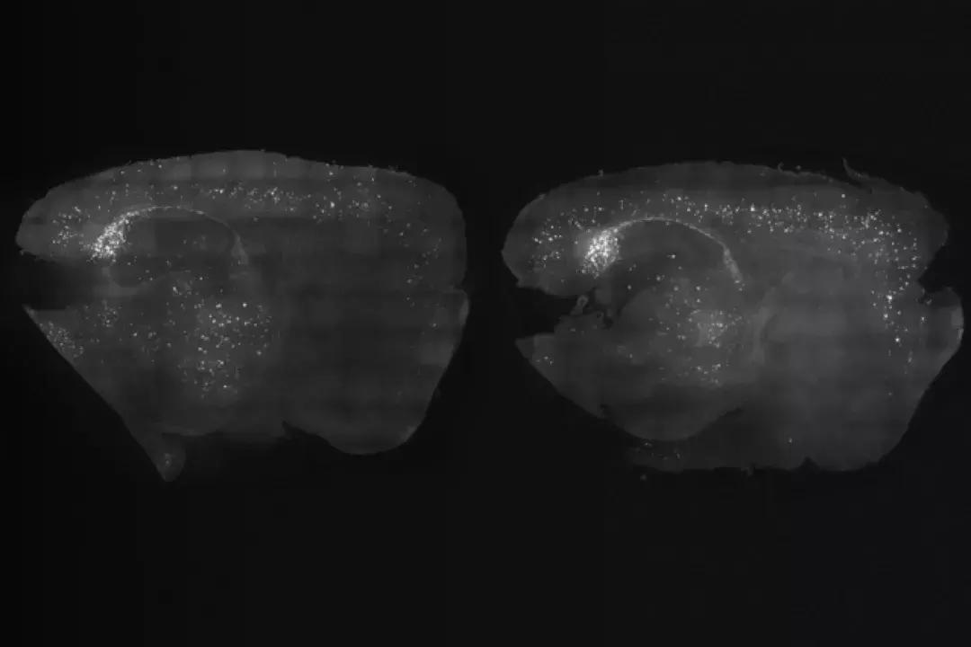 刺激大脑预防老年痴呆声音,十五赫兹音乐治疗老年痴呆症