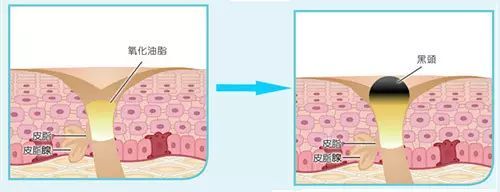 赵丽颖黑头,赵丽颖素颜照片真实对比