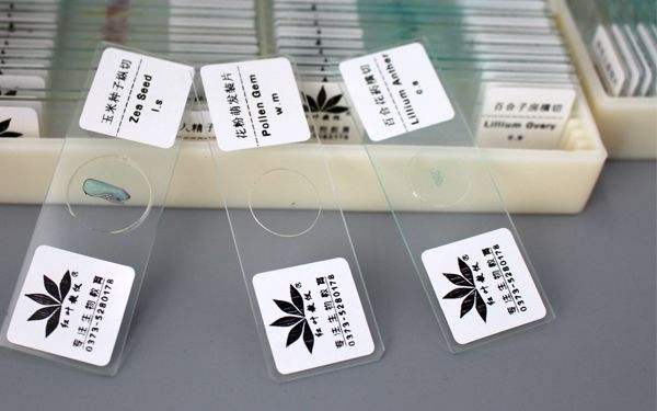 看了体检报告我懵了，这是不是宫颈癌？