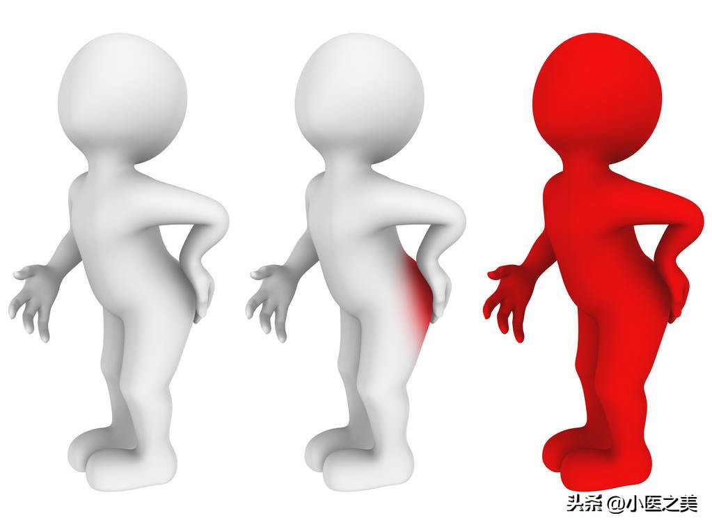 痔疮大便后小便有血怎么回事,大便后痔疮出血怎么办