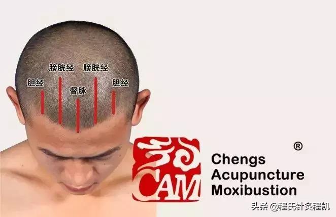 头痛厉害的一招解决方法,最严重的头痛有哪些