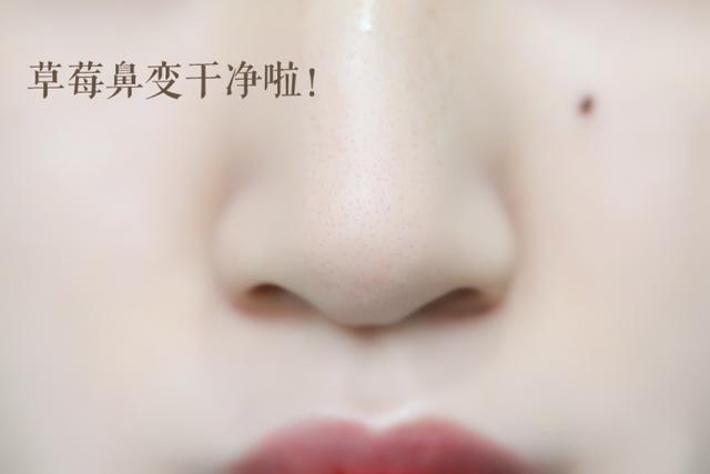 去黑头巨好用护肤品套装,草莓鼻去黑头套装