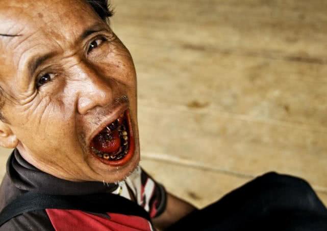 嚼槟榔是好事还是坏事,长时间吃槟榔有什么问题