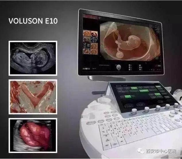 胎儿畸形筛查超声,胎儿系统性畸形筛查