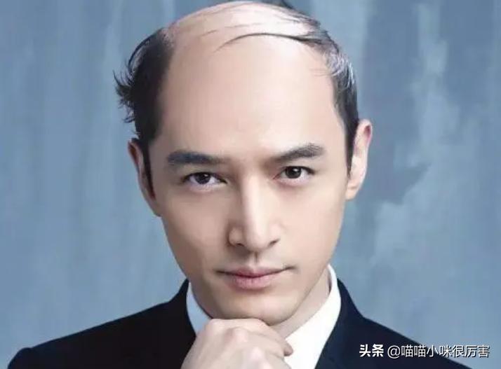 有刘海才好看的明星,有刘海超好看的明星