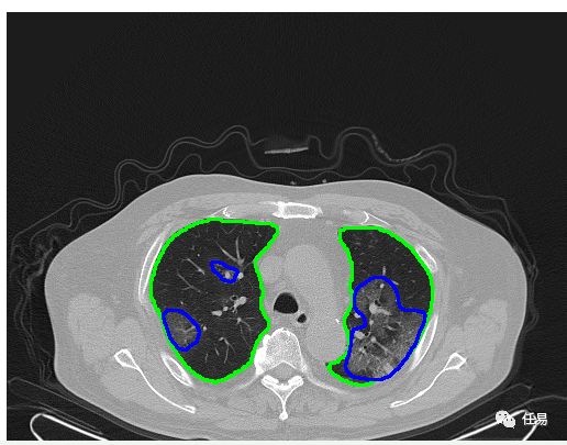 中国新冠为什么控制这么好,新冠病毒是不是地球的自我拯救