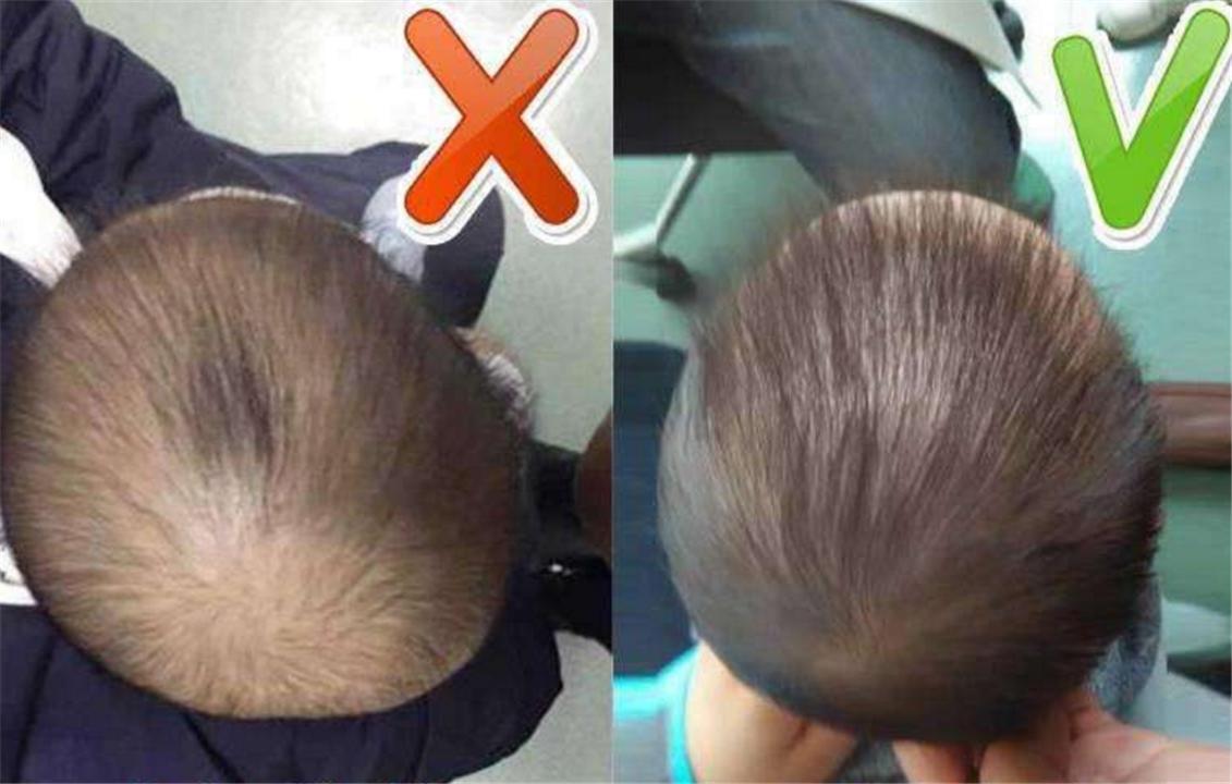 5岁后脑勺平怎么补救,女孩后脑勺平