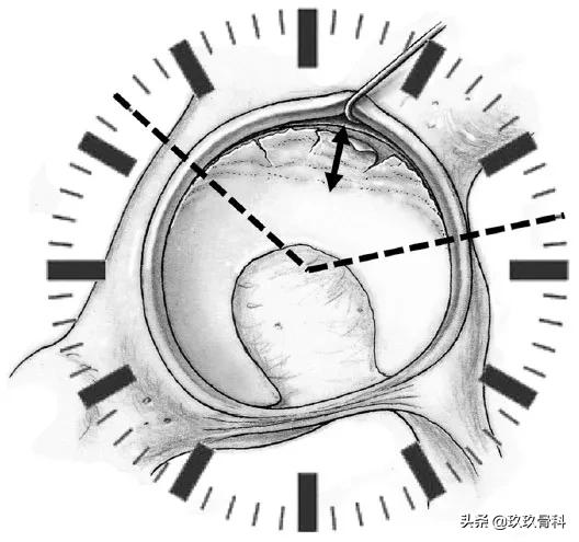 髋膝关节文献精译荟萃