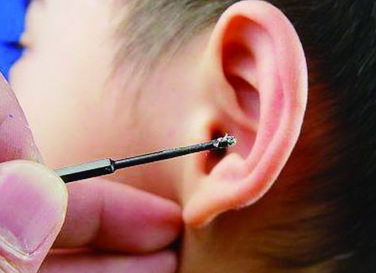 孩子耳朵里进虫子处理视频,孩子耳朵里进虫子