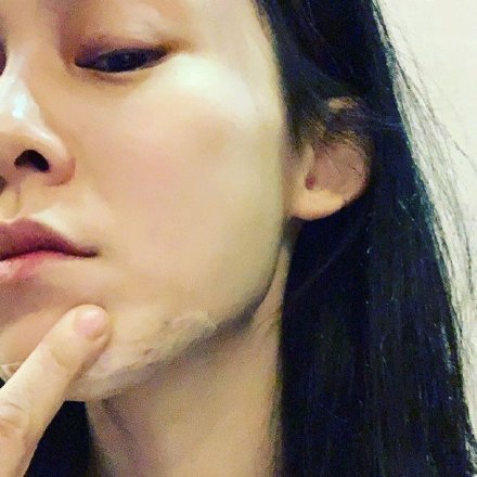 范玮琪下巴缝十五针，网友：“这是神的旨意，你可赶紧闭嘴吧！”