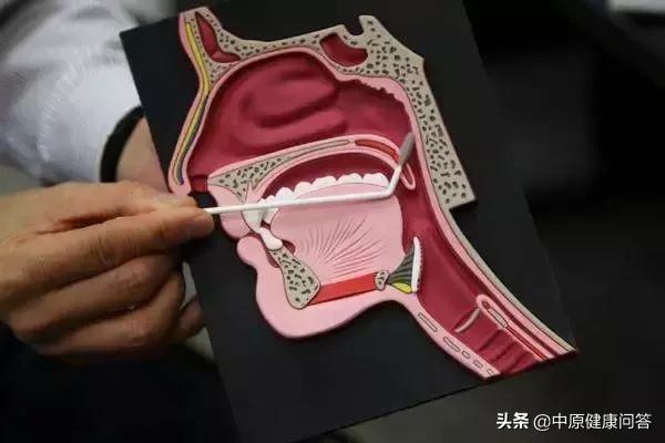 怎么预防喉癌,如何预防喉癌