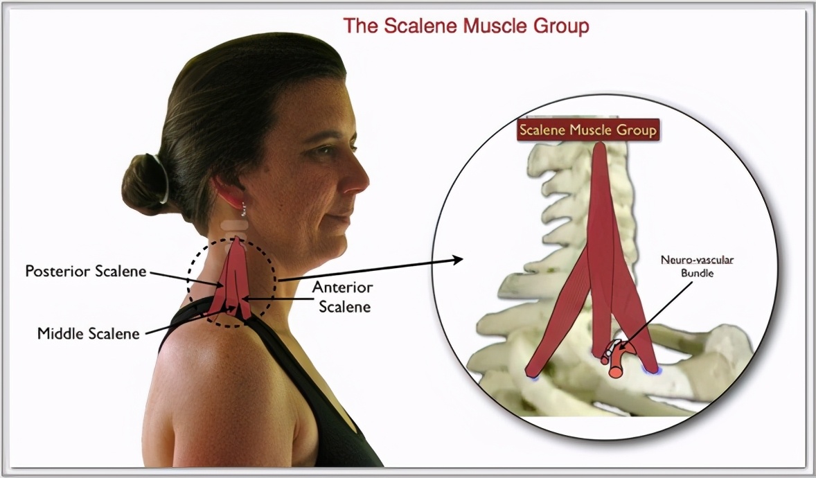 脖子僵硬手麻看病挂哪个科,颈部神经压迫手部麻木缓解动作