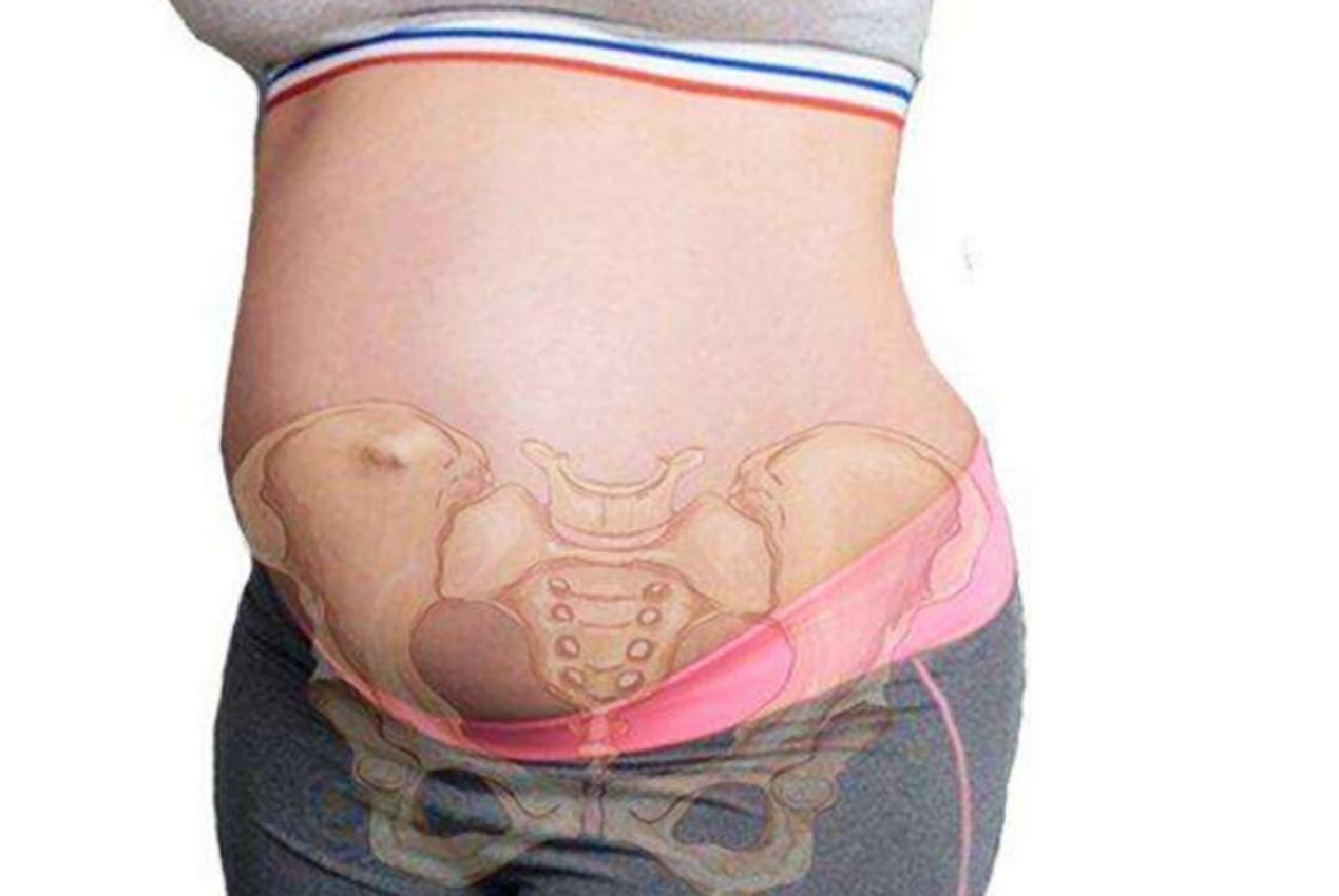 每个孕妈都有耻骨痛吗,孕几个月出现耻骨疼