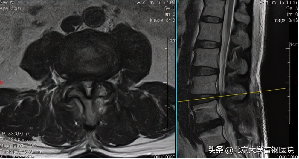 北京首钢医院骨科专家名单,北京大学首钢医院骨科团队照片