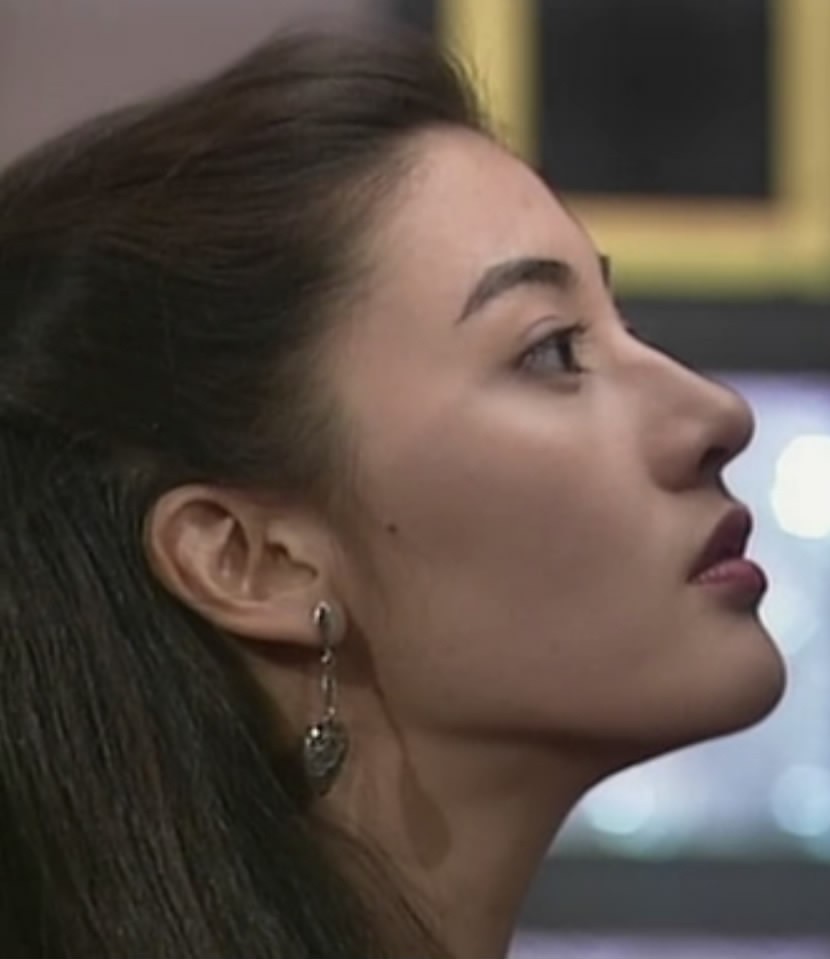 颧骨高适合什么修饰,颧骨塑造