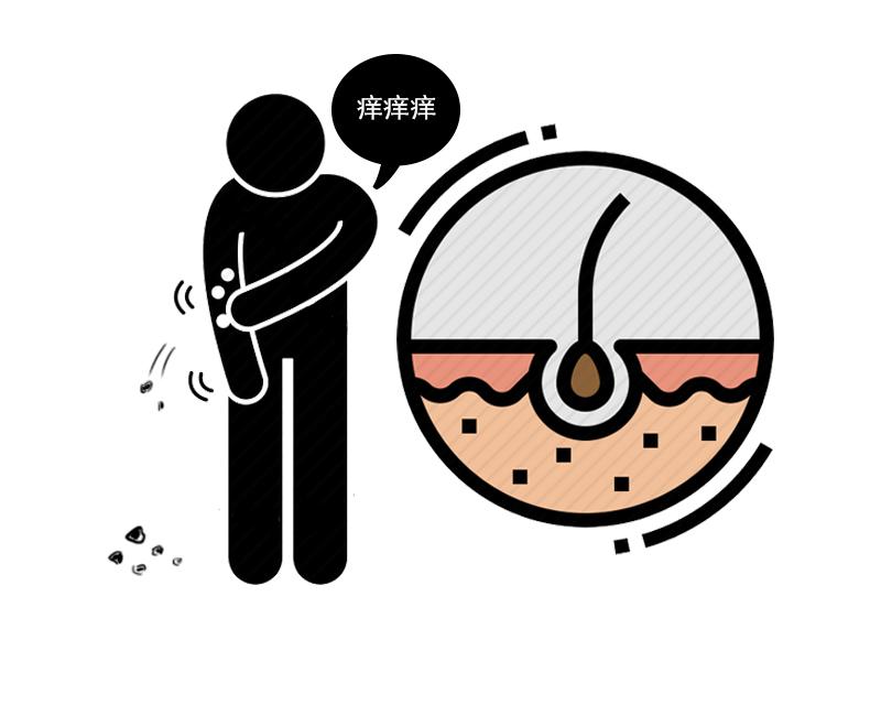 湿疹瘙痒反复发作怎么办,湿疹经常反复发作怎么治疗