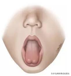 鍝轰钩鐨茶鐤肩棝,鍝轰钩鏈熶钩鑵虹値涔冲ご鐨茶