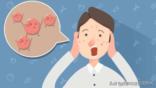 皮肤病用激素药的副作用,皮肤病滥用激素危害多