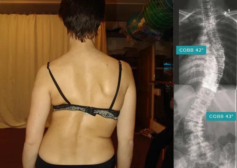 sps鍒涘浜虹悊鏌ュ痉,鐞嗘煡寰蜂翰鎺坰ps瀵煎笀