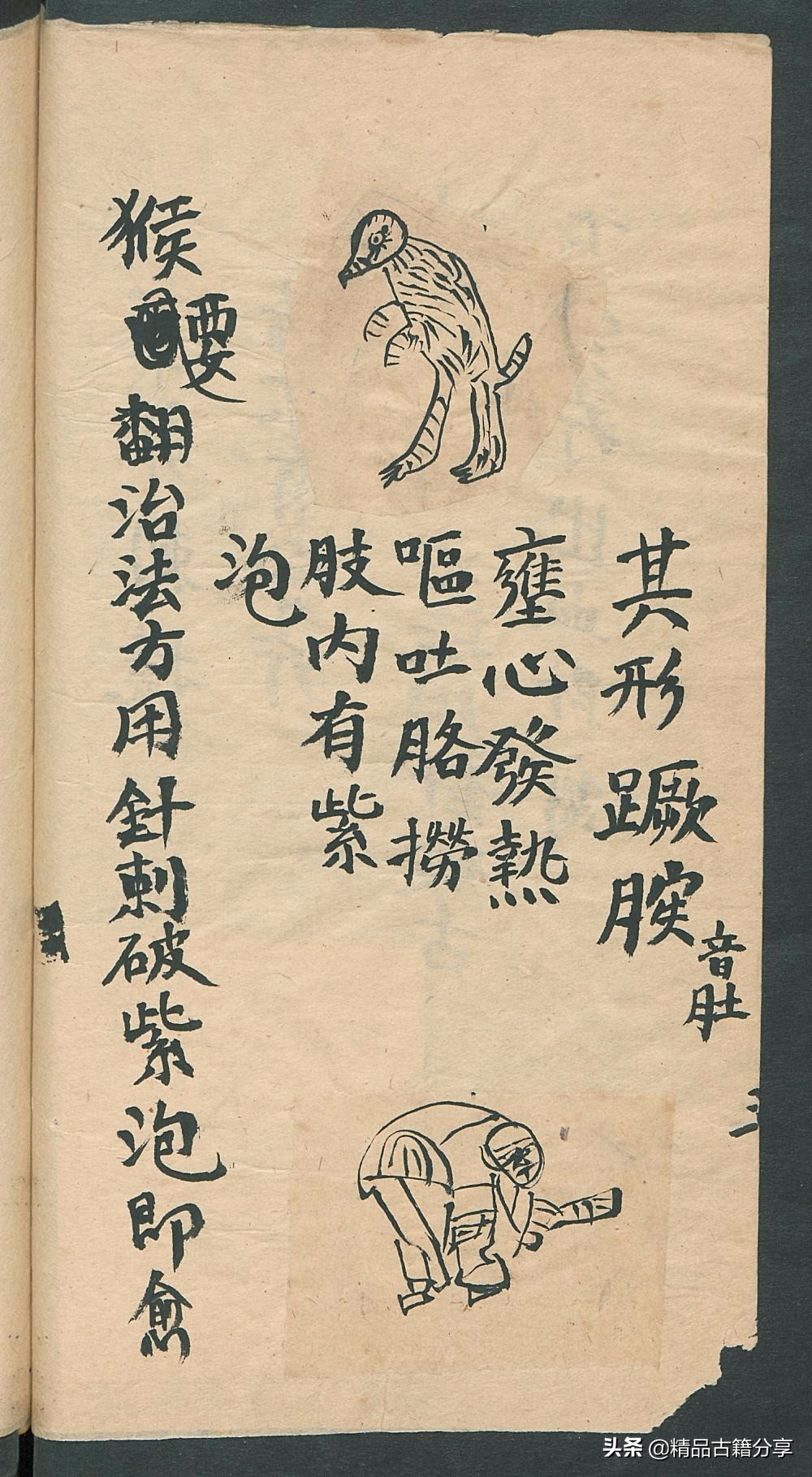 民间中医古籍书籍大全,民间看病书