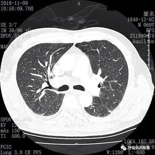 怎么应用统计学做调查,统计学方法可以解决的主要问题