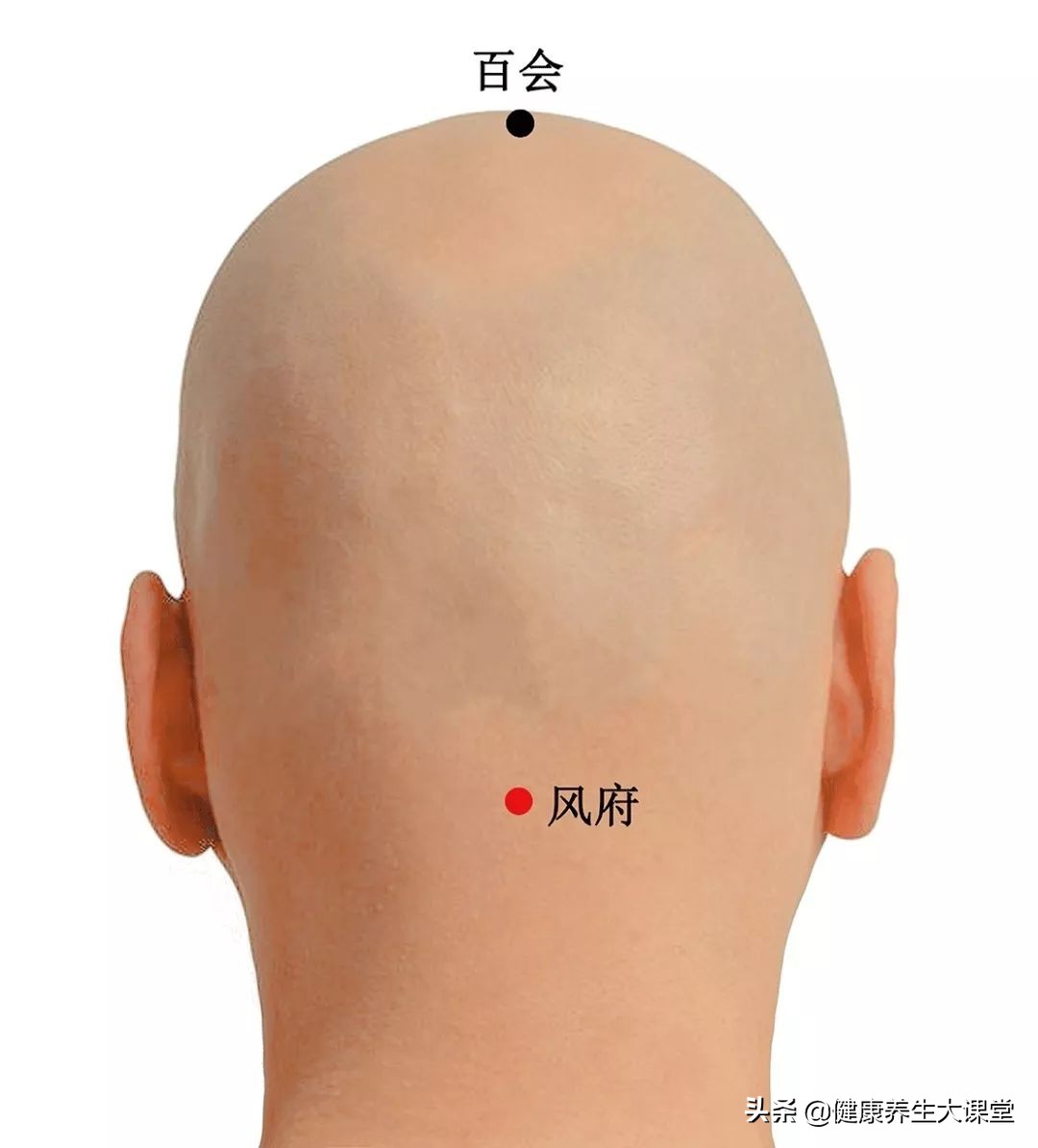 铲平富贵包,平整富贵包