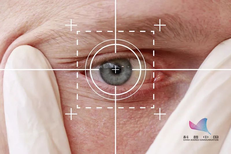 近视手术能做吗安不安全,近视手术能不能做