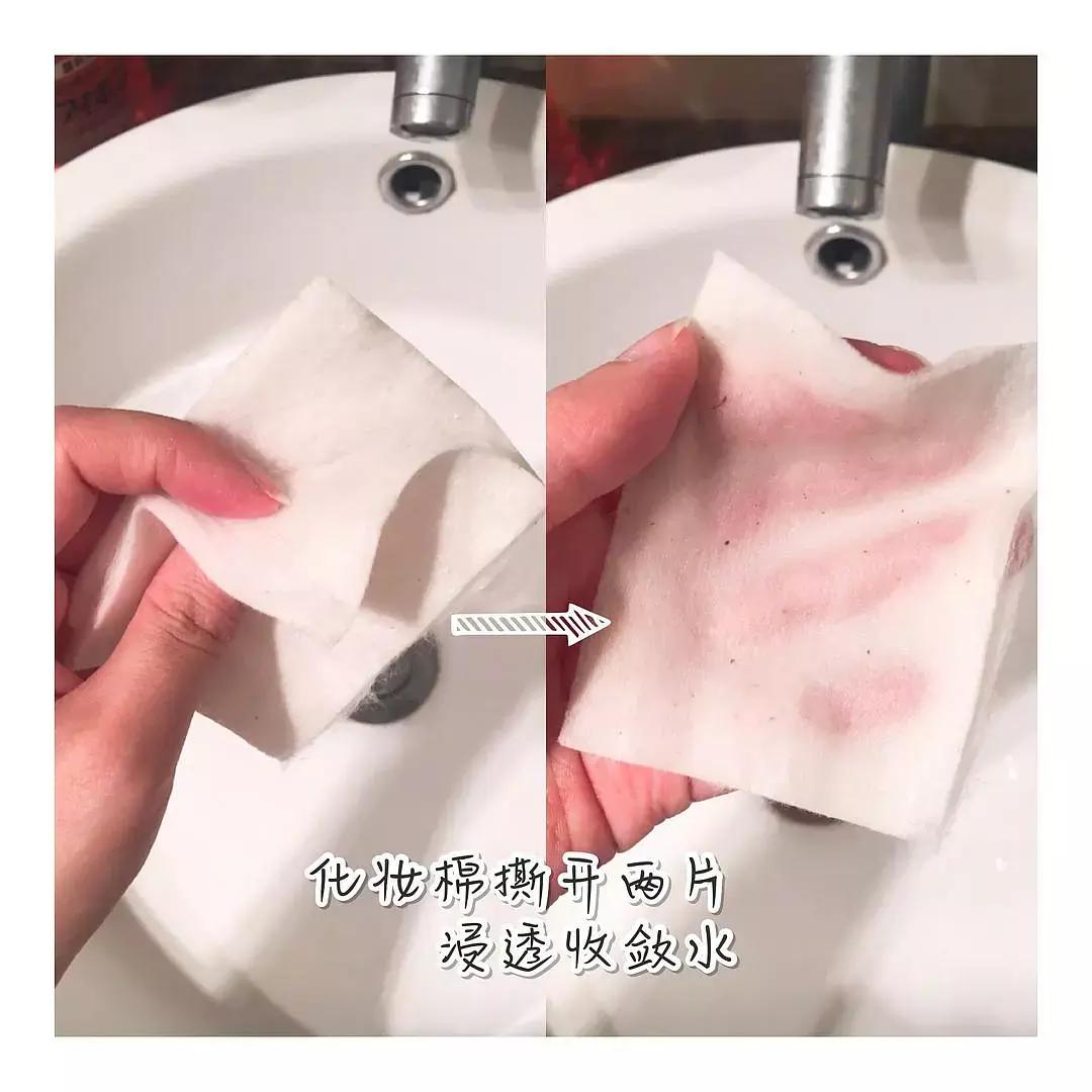 黑头可以用什么方法彻底清除,消除黑头简单有效的方法